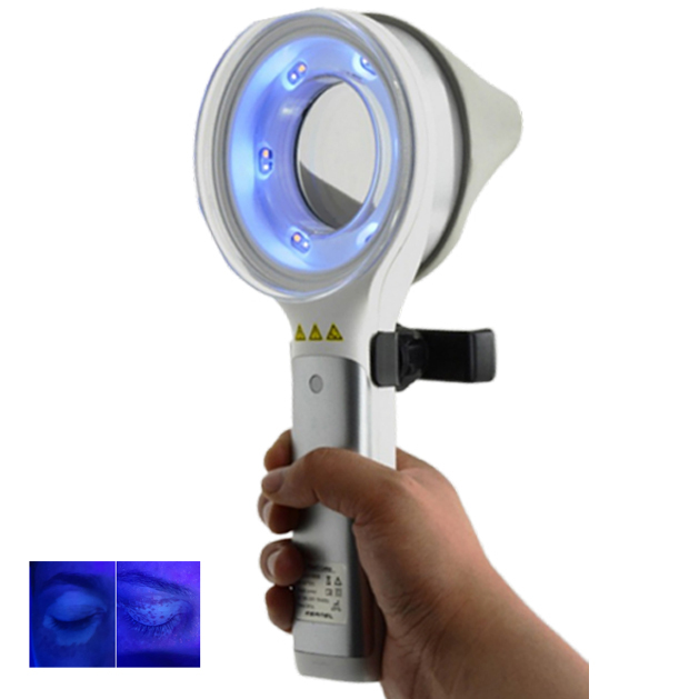 Zaburzenia Skóry  Depigmentacj – Led Medical Headlight recenzja i cena